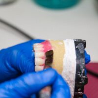 Close up of denturist making dentures at TrueFit Denture Centre in Surrey